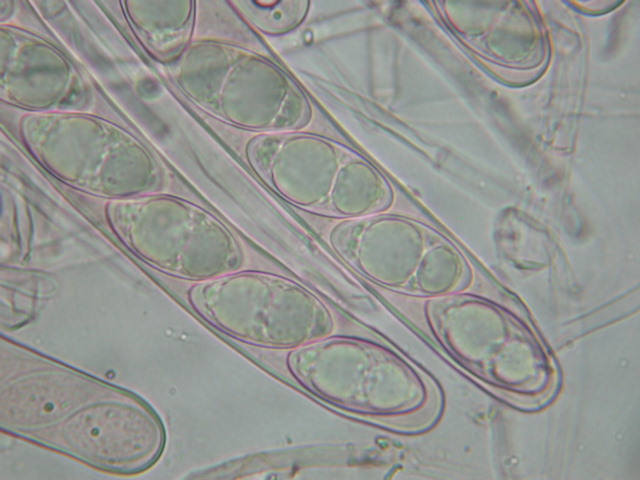 Geopora sumneriana ... in MICRO